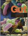 Gut：饮食中抗氧化剂摄入或阻断胰腺癌发病风险