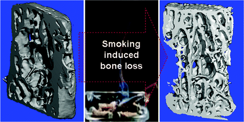 J Proteome Res：科学家解决<font color="red">吸烟</font>弱化骨骼之谜