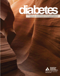 Diabetes：2型糖尿病患的功能性大脑连接显著下降