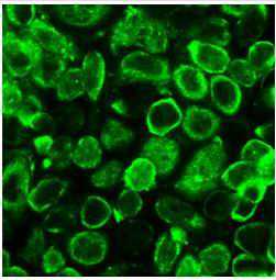 PLoS ONE：P-糖蛋白调节卵巢癌细胞耐药性