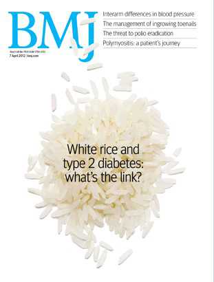 BMJ:贝伐珠单抗和雷珠单抗治疗糖尿病黄斑水肿无显著性差异