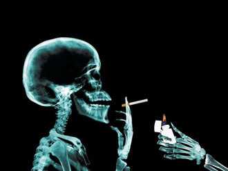 JNCI：吸烟影响鼻咽癌发病及诱导EB病毒活动