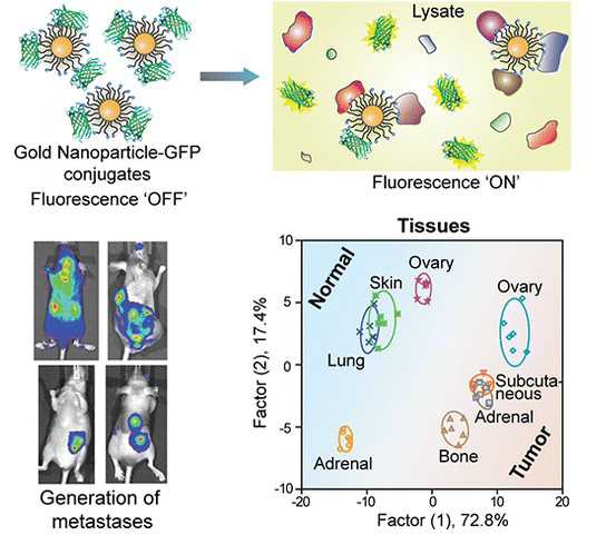 ACS Nano：纳米-GFP 感受器可检测不同转移癌