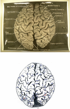 Brain：研究描绘爱因斯坦整个<font color="red">大脑</font><font color="red">皮层</font>