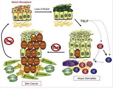 Cancer Cell：<font color="red">胸腺</font>基质淋巴生成<font color="red">素</font>（TSLP）或抵御皮肤癌