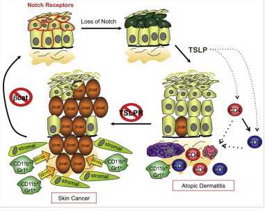 Cancer Cell：胸腺基质<font color="red">淋巴</font>生成素（TSLP）或抵御皮肤<font color="red">癌</font>
