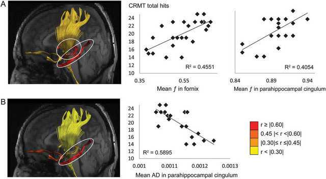 NEUROLOGY ：轻微认知障碍患者的情景记忆与多个颞<font color="red">叶</font>相关通路结构相关