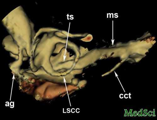 IJPO:HRCT与3DVR CT可良好描述先天性耳道闭锁合并小耳畸形