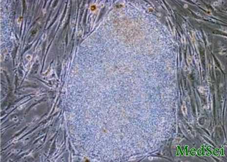 CELL STEM CELL：日培育出肿瘤<font color="red">抗原</font><font color="red">特异性</font><font color="red">T</font><font color="red">细胞</font>