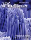 Nat Neur：揭示短期记忆转长期记忆分子机制
