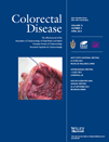 Colorectal Dis：注水结肠镜检查显著降低患者不适