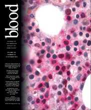 Blood：开发出治疗淋巴瘤的新型疗法