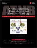 ATV Biol：抑制Notch 1<font color="red">路</font>径或可减小腹部主动脉瘤的恶化