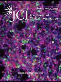 JCI：血脑屏障的免疫交换或助力多发性硬化症研究
