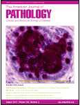 Am J Pathol：揭示治疗硬皮病的新型靶点