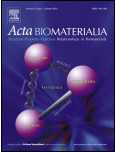 Acta Biomater：新型干细胞装载<font color="red">运输</font>技术可帮助眼睛受损者重获光明