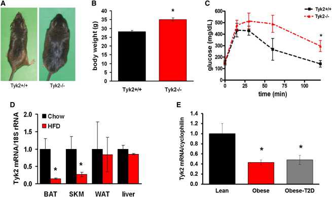 Cell Metab：操纵Tyk2成功逆转小鼠肥胖