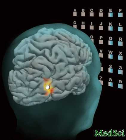 NeuroImage:  微创脑机接口实现思维打字