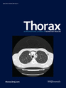 Thorax：新型口服抗凝药治疗肺栓塞具有更高的安全性