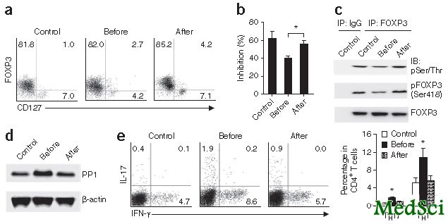 Nat Med：上海免疫所研究者发现英夫利西单抗通过FOXP3<font color="red">磷酸</font>化修复RA患者受损的Treg细胞功能