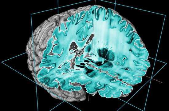 Science：科学家公布迄今最清晰人类大脑3D图像（BigBrain）