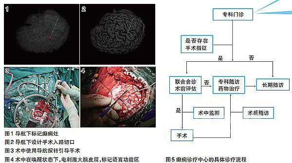 神经内科多学科联合诊治在疾病中应用实例