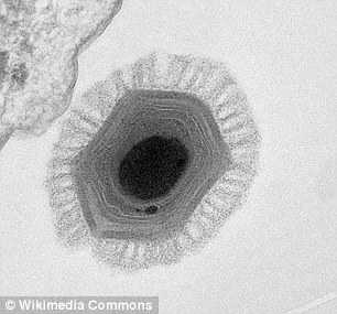 法科学家发现史上“最大”病毒——<font color="red">潘多拉</font>病毒，直径达1微米