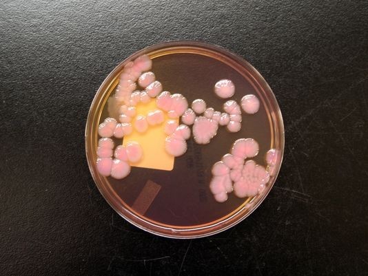美报告称耐药菌每年夺去2.3万人生命