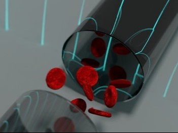 英研究出微波指尖采血4分钟诊断贫血病
