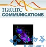 Nat Commun：研究发现<font color="red">蛋白</font>Ecscr与代谢疾病有关