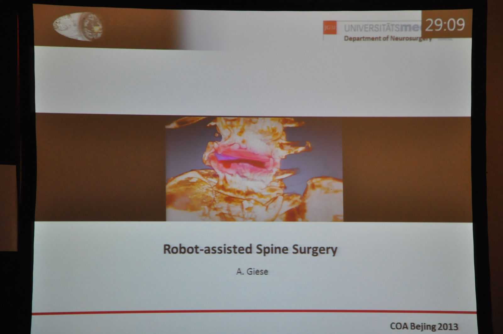 COA学术外籍专家精彩回顾（1）机器人辅助手术