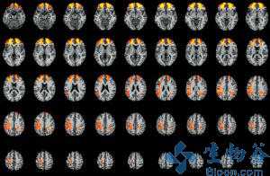 Brain:科学家鉴定出理解语言的脑区