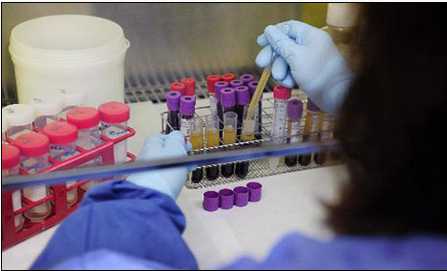 西班牙将对艾滋病感染者进行治疗性疫苗试验