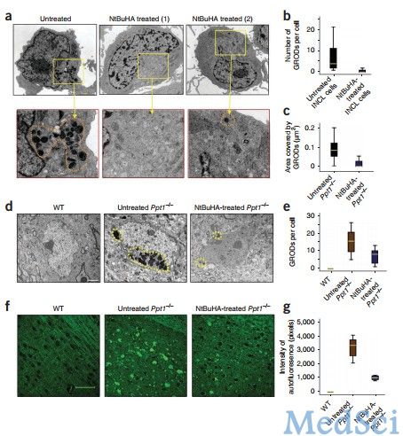 Nat Neurosci：新发现药物或可用于治疗巴藤病