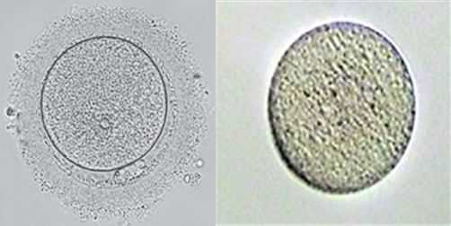 NEJM：首次破译人卵透明带缺失致病基因