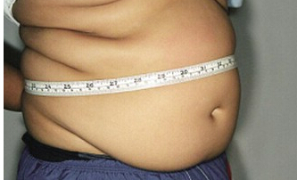 Pediatr Obes：BMI可漏诊超过25%脂肪<font color="red">超标</font>的儿童