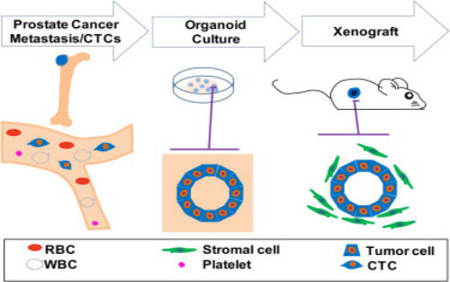 Cell：华人学者首次培育出前列腺癌类器官