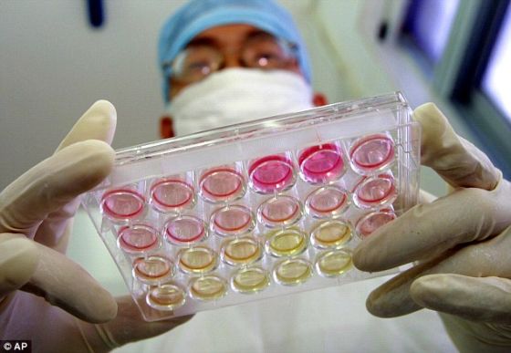 法科学家揭HIV感染者自愈机制