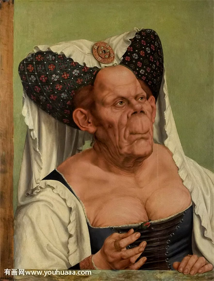 《妇人肖像》---变形性骨炎
