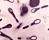 Cell Res：艰难梭菌感染治疗有新靶点