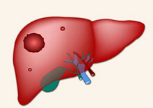 Hepatology：USP7将加速肝癌的发展