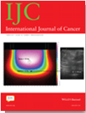Int J Cancer：多巴胺或可用于5-FU引发中性粒细胞减少的治疗