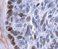 Cell Stem Cell：皮肤癌起始、生长<font color="red">及</font><font color="red">恶化</font>的分子机制
