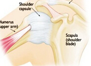 关节镜下肩周炎微创松解手术1例