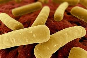Clin Infect Dis：复发性艰难梭状芽胞杆菌感染的管理