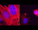 科学家最<font color="red">新发现</font>：注射细菌杀灭癌细胞！
