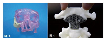 3D打印“骨骼”的应用