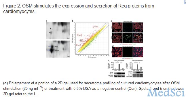 Nat Med：Reg3β依赖性<font color="red">巨噬细胞</font>促进心肌愈合