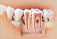 J Periodontol：<font color="red">代谢</font>综合征可增加患牙周病的风险