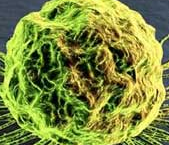Oncogene：中科院健康所发现增强免疫应答抗肿瘤新机制